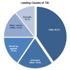 4 Factors To Consider When Dealing With Brain Injury Claims