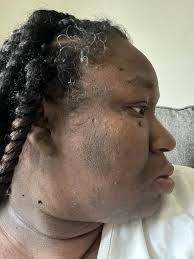 Hello, wondering if anyone knows where I can get my skin checked out as I  have some issues with it and I'm concerned for. I have no family doctor  been waiting a