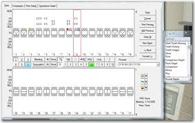 Voice Module