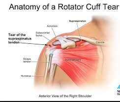 The scapula (shoulder blade), clavicle (collarbone) and humerus (upper arm bone). Anatomy Of A Rotator Cuff Tear Archives Arizona Institute For Sports Knees And Shoulders