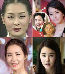 Nose job, eyelid surgery and jawbone. Korea Observer Lee Da Hae S Plastic Surgery