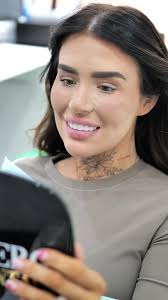 🦷 Thinking About Improving Your Smile? We love this stunning nano-hybrid  composite bonding transformation done by our very own Dr Salim Karimi from  our Synergy dental Oldham clinic 😍 Composite bonding ...