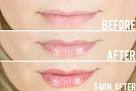 Extreme lip injection lip gloss