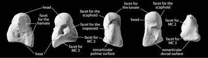 Image result for Pisiform Bone