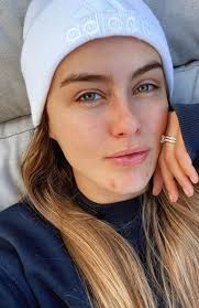 Laura Henshaw: Makeup-free selfie highlights reality of changing skin