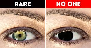For example, some people inherit a mutation (change) in the bap1 tumor suppressor gene, which raises their risk of eye melanoma and some. Why Humans Don T Have Black Eyes