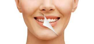 Check spelling or type a new query. Smile Makeover What Are The Treatments What Does It Cost