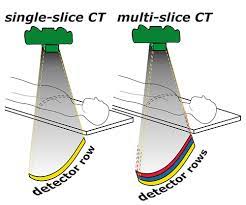 Multislice Ct Scan Ppt Ct Scan Machine