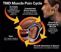 Jaw Pain Temporomandibular Joint Pain Complete Spine And Pain Care
