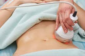 See a demonstration of a laser hair removal treatment with expert skin care tips in this free hair removal video clip.expert: Nova Derm Institute Medical Spa And Laser Center In Leesburg Va