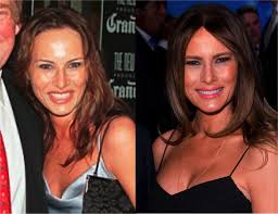 Donald additionally has a daughter, tiffany . Trump S Women Plastic Surgery Last Night Instead Of Sleeping This By Sheryl Canter Medium