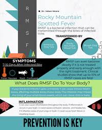 That's why your doctor will probably have you begin. Rocky Mountain Spotted Fever Dr Jaban D C