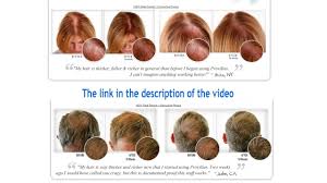 One of the most important steps to regrow hair is to understand how and why you lost your hair in the first place. How To Regrow Hair Naturally On Bald Head Youtube