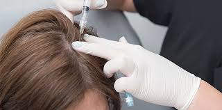 Platelet rich plasma contains up to 5 times more platelets than regular blod in our body. Hair Restoration With Prp In Toronto And Thornhill Dr Larry Fremont