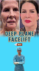 Dr Justin Perron Australia