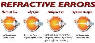 Refractive Errors Eyes Problems Eye Exercises Homeopathy