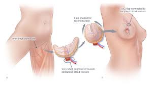 Pin On Tug Flap