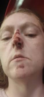 Homeless person needs food