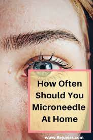 We did not find results for: How Often To Microneedle Hair Arxiusarquitectura