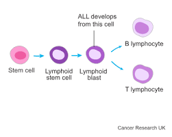 Image result for Acute Leukemia