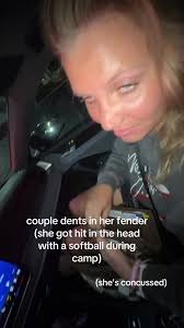 Softball Camp Injury: Dents in Forehead Explained