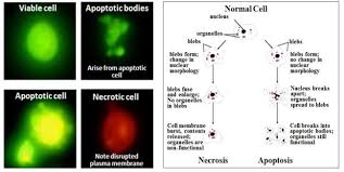 What are the characteristics of a benign tumor? 19 5 Disruption Of The Cell Cycle Checkpoints Can Cause Cancer Biology Libretexts