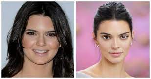 Y es que mientras que en algunas el cambio apenas es notorio, otras transformaron su rostro por completo. 10 Famosos Con Bichectomia Antes Y Despues Dr Edwin Vasquez