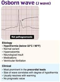 Image result for J Wave