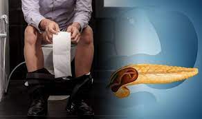 Cancer at this stage may also be called metastatic or advanced cancer. Pancreatic Cancer Symptoms Signs In Your Poo That Could Signal The Deadly Disease Express Co Uk