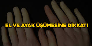 El Ve Ayaklarin Cok Usumesine Dikkat El Ayak Usumesi Neden Olur