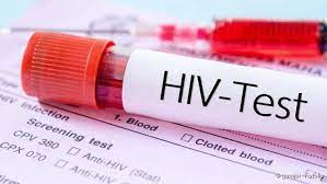 Aids Und Hiv Beschreibung Symptome Behandlung Netdoktor