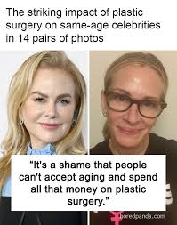 The striking impact of plastic surgery