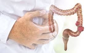 In particular, a greater frequency of bowel movements and looser stool may be a sign of colon cancer. Bowel Cancer Symptoms The Colour Of Your Stools Could Signal The Deadly Disease Express Co Uk