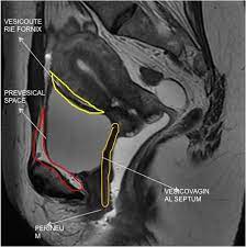 An mri is an exam that uses a magnetic field and radio waves to create detailed images of the organs and tissues within your body. Epos C 0815
