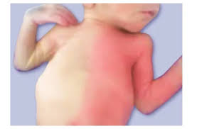 Image result for Harlequin Color Change