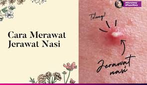 Cara hilangkan jerawat dengan timun cukup mudah, caranya kisar timun dan tapiskan hampasnya. Cara Menghilangkan Jerawat Nasi Pada Wajah Puan Mary