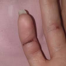 Wer sichergehen möchte, zeigt auch eine beginnende, leichte immer noch schneiden viele menschen das nagelhäutchen mit einer schere ab oder schieben die haut unsanft mit einem der arzt kann eine nagelbettentzündung meist mit einer einfachen blickdiagnose erkennen. In Finger Geschnittten Was Tun Gesundheit Und Medizin Gesundheit Medizin