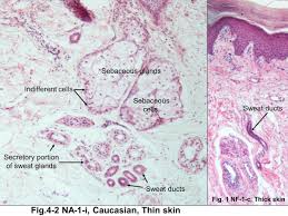 Image result for Sebaceous Gland
