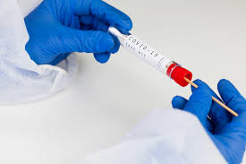 Termasuk Tes Cepat Apa Itu Rapid Antigen Test Jovee Id