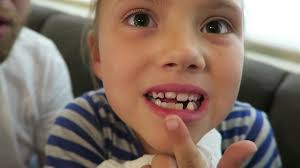 My first would cut teeth in a matter of days. How To Pull Out A Tooth Youtube
