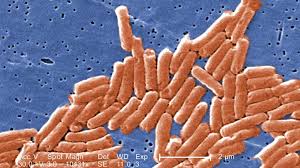 Cdc estimates salmonella bacteria cause about 1.35 million infections, 26,500 hospitalizations, and 420 deaths in the united states every year. Monitoring For Salmonella In Swine In The Netherlands Articles Pig333 Pig To Pork Community