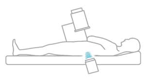 Urinary Stones | Chin Chong Min Urology & Robotic Surgery Centre