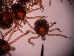We did not find results for: The Little Chigger Bug Bite Hubpages