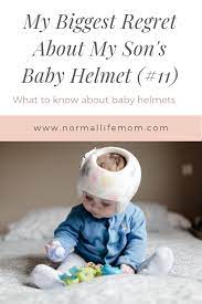 What Parent S Need To Know About A Baby Helmet Baby Helmet Baby Development Activities Flat Head Baby