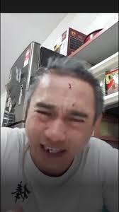 那么多网肺中棒棒哥是最敬业的！把自己头敲bao了😅