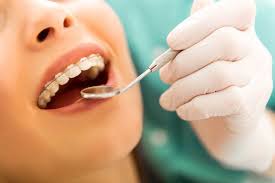 Ceramic braces blend in with your natural teeth and are not visible. How Much Do Braces Cost Westwood Dental Houston