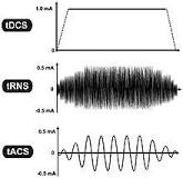 Image result for why do you think that pairing tdcs with a treatment is necessary to elicit behavioral changes?