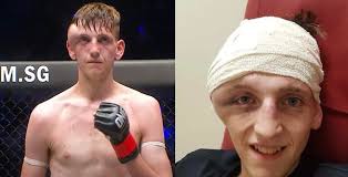 George Mann's head after receiving a powerful left punch! :  r/oddlyterrifying