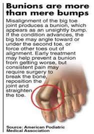 Pin On Foot Health