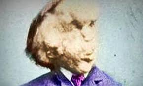 I am a human being! Top 10 Interesting Facts About The Elephant Man Listverse